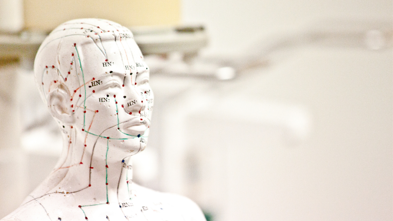 acupuncture